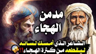 الشاعر الذي هجا أمه وأباه وخاله وعمه والقبائل ونفسه حتى أمر الفاروق بحبسه 