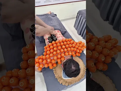 Cupping Therapy Trick 😅