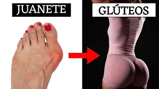 Convertí un Juanete en Glúteos Grandes