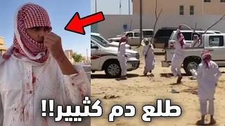 الولد هذا ضرب خويه على راسه!