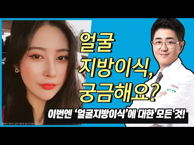 압구정성형외과) 얼굴지방이식수술 후 붓기부터 유지기간 및 후관리는?