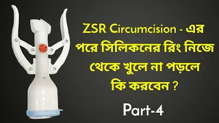 zsr circumcision best circumcision in kolkata