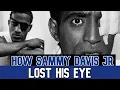 How Sammy Davis Jr Lost His Eye - The Untold Triumph Shocking True Story