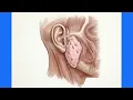 Reactive Preauricular and Intraparotid Lymph Nodes Ear Infection Ultrasound Features Prognosis
