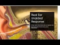 Download Lagu Real Ear Measurement and Speech Mapping with Ms. Amy Lennox