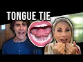 Download Lagu Is Your Tongue Holding You Back? - Tongue Tie Evaluation