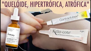 MASSAGEM na CICATRIZ com ÓLEO de ROSA MOSQUETA | Como tratar quelóide #cicatrizes #queloide