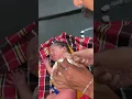 Download Lagu Bcg vaccination given baby afterbirth #newbornbaby #babygril #babychoice #vaccinator #baby #newborn