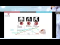 Understanding Right Heart Failure From a Bench to a Platform with Dr Lisa Mielniczuk MD
