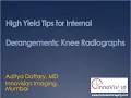 Knee X Ray Internal Derangements