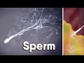 Lagu What Is Sperm?What is sperm made of? medical animation #sperm #fertilization