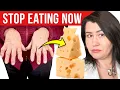 7 TOXIC Foods for Arthritis - Don t Eat