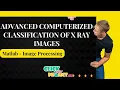 Matlab Image Processing Project - Computerized Classification Of X-Ray Images