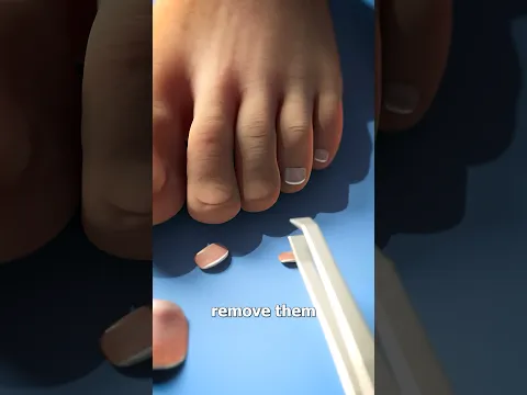 Removing Your Toenails 😱 Doctor Reacts