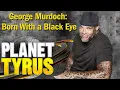 George Murdoch Born With a Black Eye