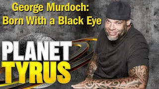 George Murdoch Born With a Black Eye