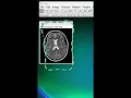 3D in ImageJ awesome
