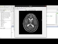Digital Watermarking Using Discrete Wavelet Transform for Medical images in MATLAB