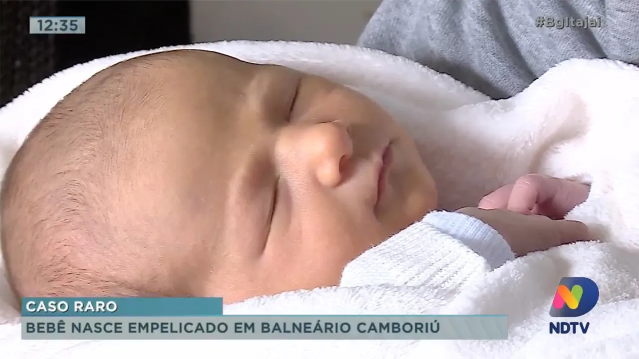 Bebê nasce empelicado em Balneário Camboriú