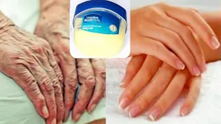 HOW TO REMOVE WRIKLES FROM HANDS AND FINGER