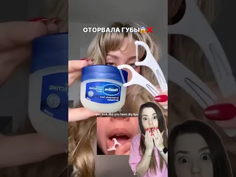 ОТОРВАЛА ГУБЫ😱🔥 #shorts