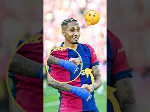 Barca's Bandage Mystery: SOLVED! 🧐