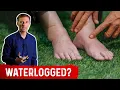 Fluid Retention On Keto Diet - Dr Berg