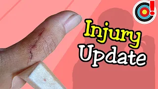 Thumb Injury Update