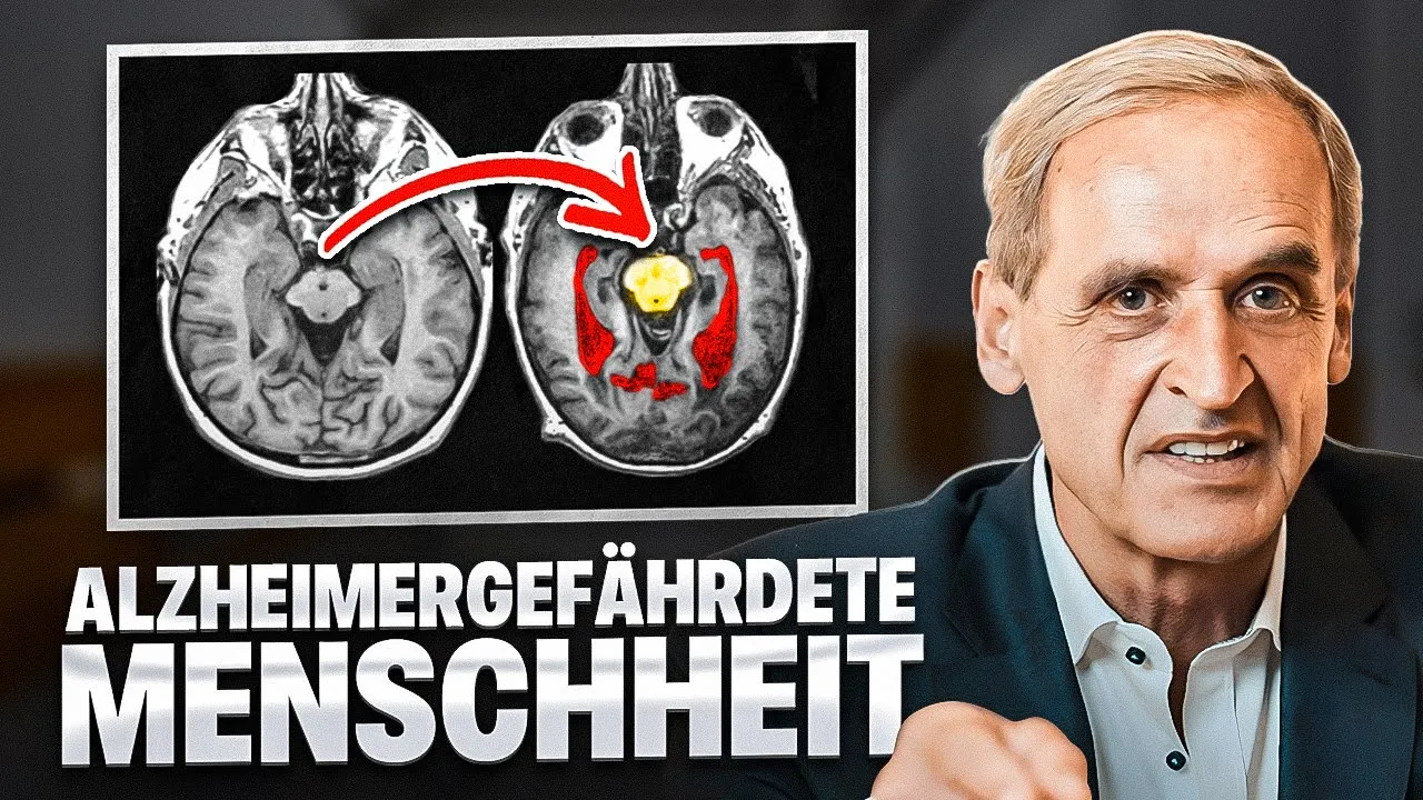 EINE EPIDEMIE STEHT BEVOR! Wird Alzheimer im Jahr 2024 verbreiteter sein als Covid?