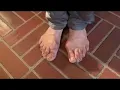 Hobbit feet