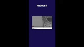 Https Www Youtube Com Watch V FZa239 2yYQ 