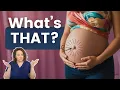 Belly Button Pain in Pregnancy Causes Relief Explained