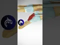 Mallet Finger - 3D Animation