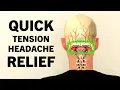 Download Lagu Tension Headache Exercises. Stress Headache Relief in 4 Minutes.