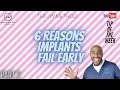 The JW Method Tip of the Week - Why your implants are failing early Part 2