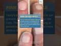 What Does the Colour of Your Nails Say About Your Health