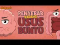 Download Lagu PENYEBAB RADANG USUS BUNTU - ANIMASI ORGAN TUBUH