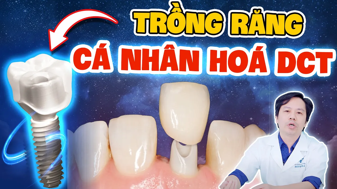 Outline Video Giải Pháp Trồng Răng Implant Cá Nhân Hoá DCT: Trồng Một Lần An Tâm Sử Dụng Trọn Đời!