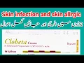 Clobeta Cream Uses in Urdu Benefits and Sideeffects skin infection Skin Rudnes