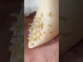 Removal Relax satisfying With Din Spa 2025