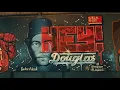 Hey! Douglas ft. Alpay - Yekte (OVERLOCK®)