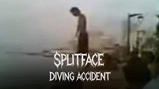 Face Split Diving Accident The Viral That Terrified the Internet