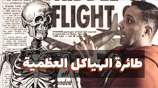 سر طائرة الهياكل العظمية 