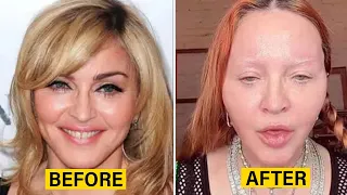 10 Celebrities Who Took Plastic Surgery Too Far