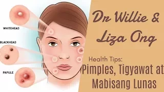 Download How to treat Pimples and Acne by Doc. Katty Go (Dermatologist) MP3