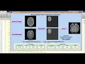 Image Fusion using Wavelet Transform matlab project source code