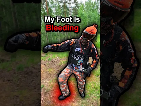 He Stepped on a NAIL