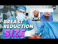 Breast Reduction Surgery How the Final SIZE Is Determined
