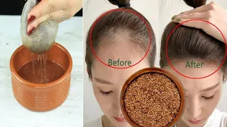 The secret🌱to incredibly fast hair growth and stopping hair loss and baldness naturally