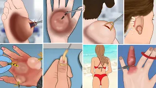 ASMR Satisfying and Relaxing Treatment Animation  for calm your mind